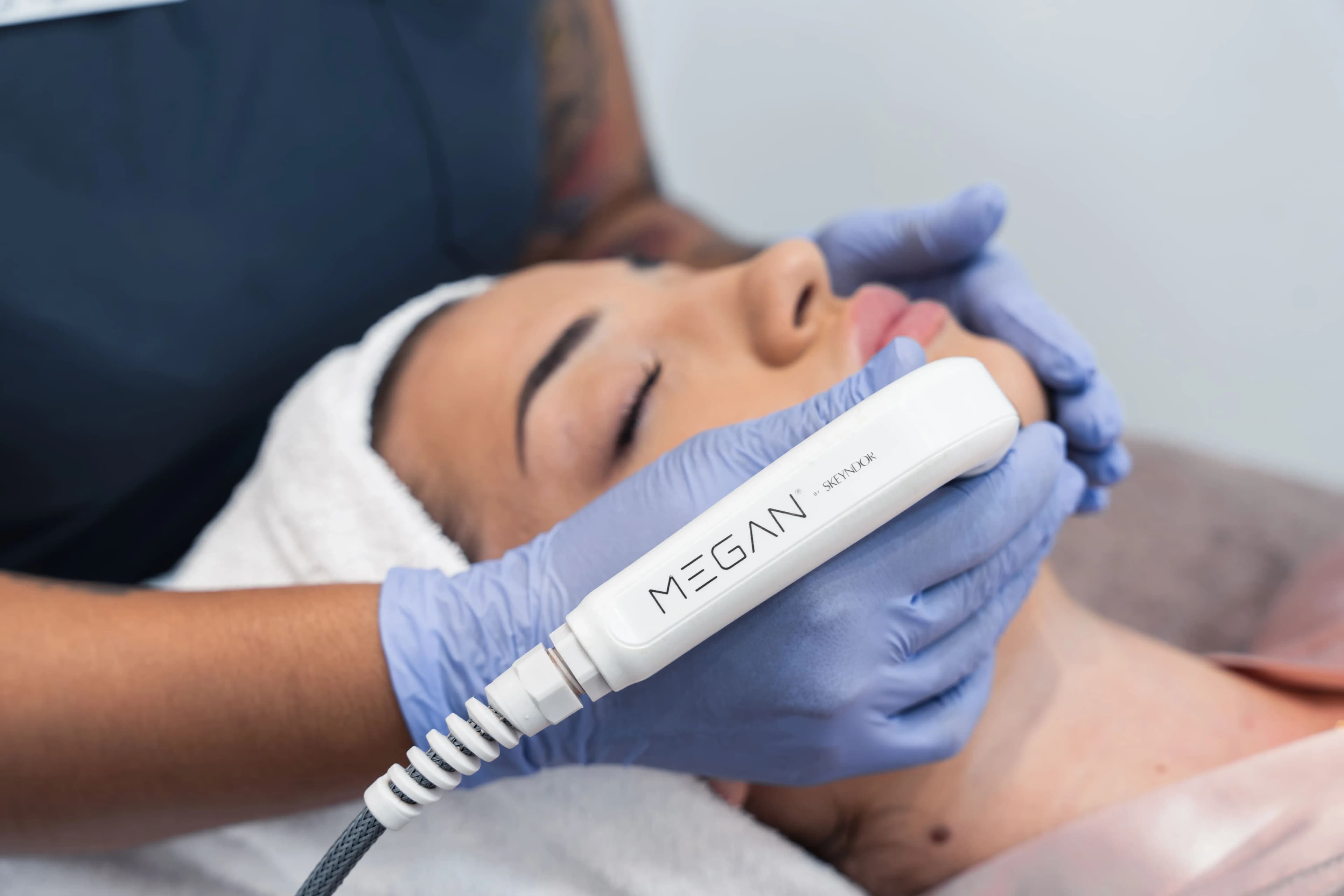 Radiofrecuencia Facial MEGAN by Skeyndor