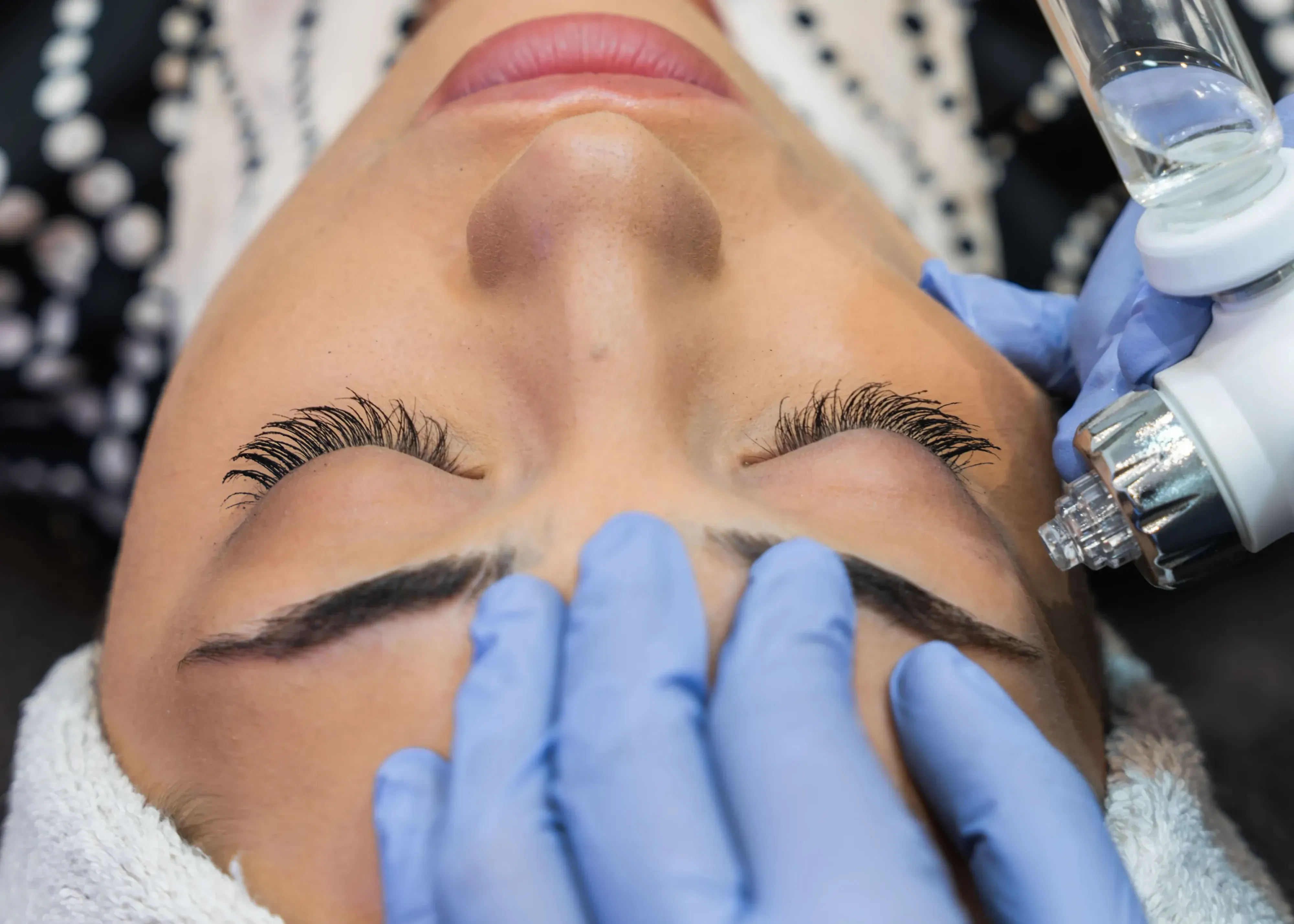 Peeling Fotoenvejecimiento – RENOCARE AGE-PEEL