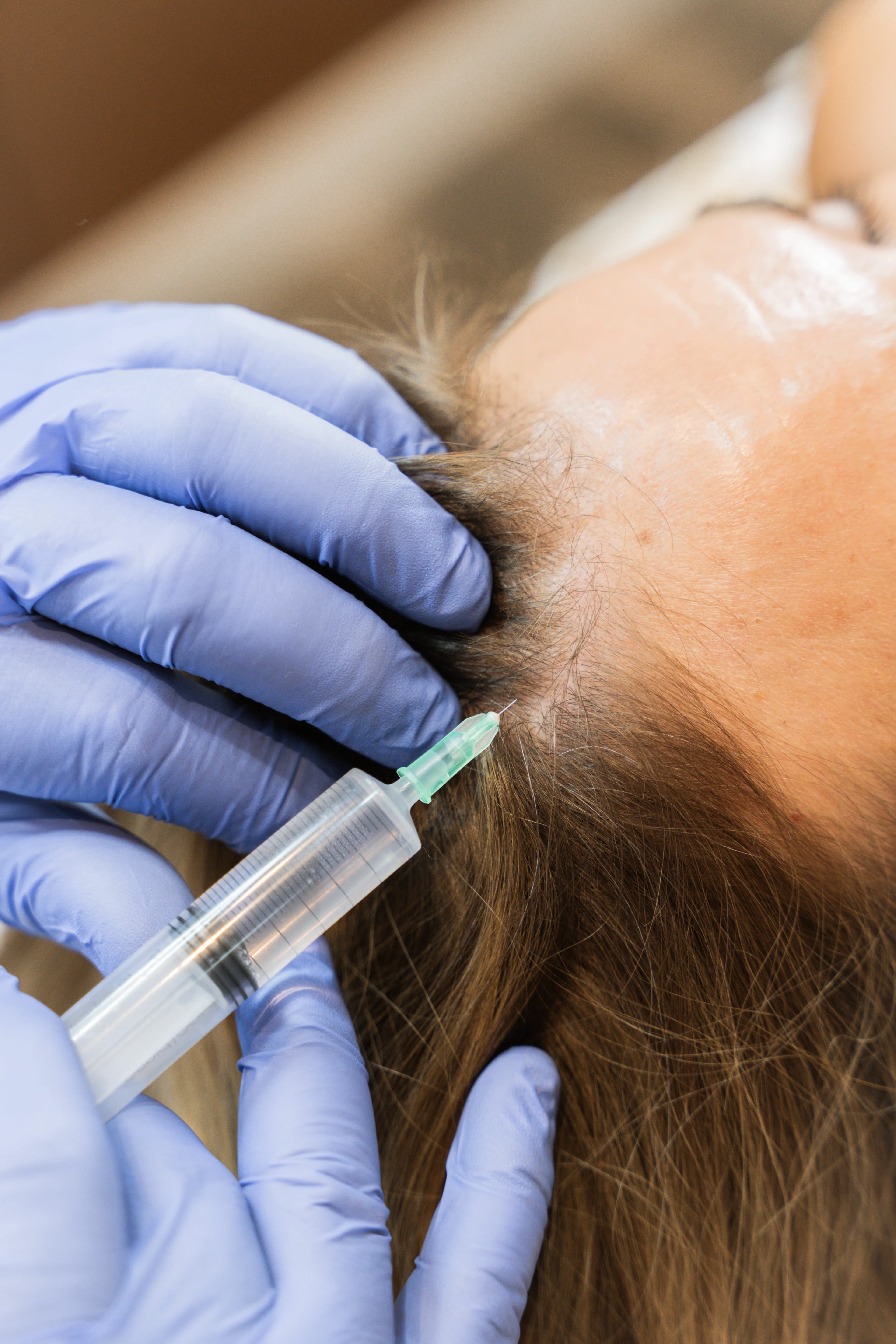 Preguntas frecuentes sobre el tratamiento capilar