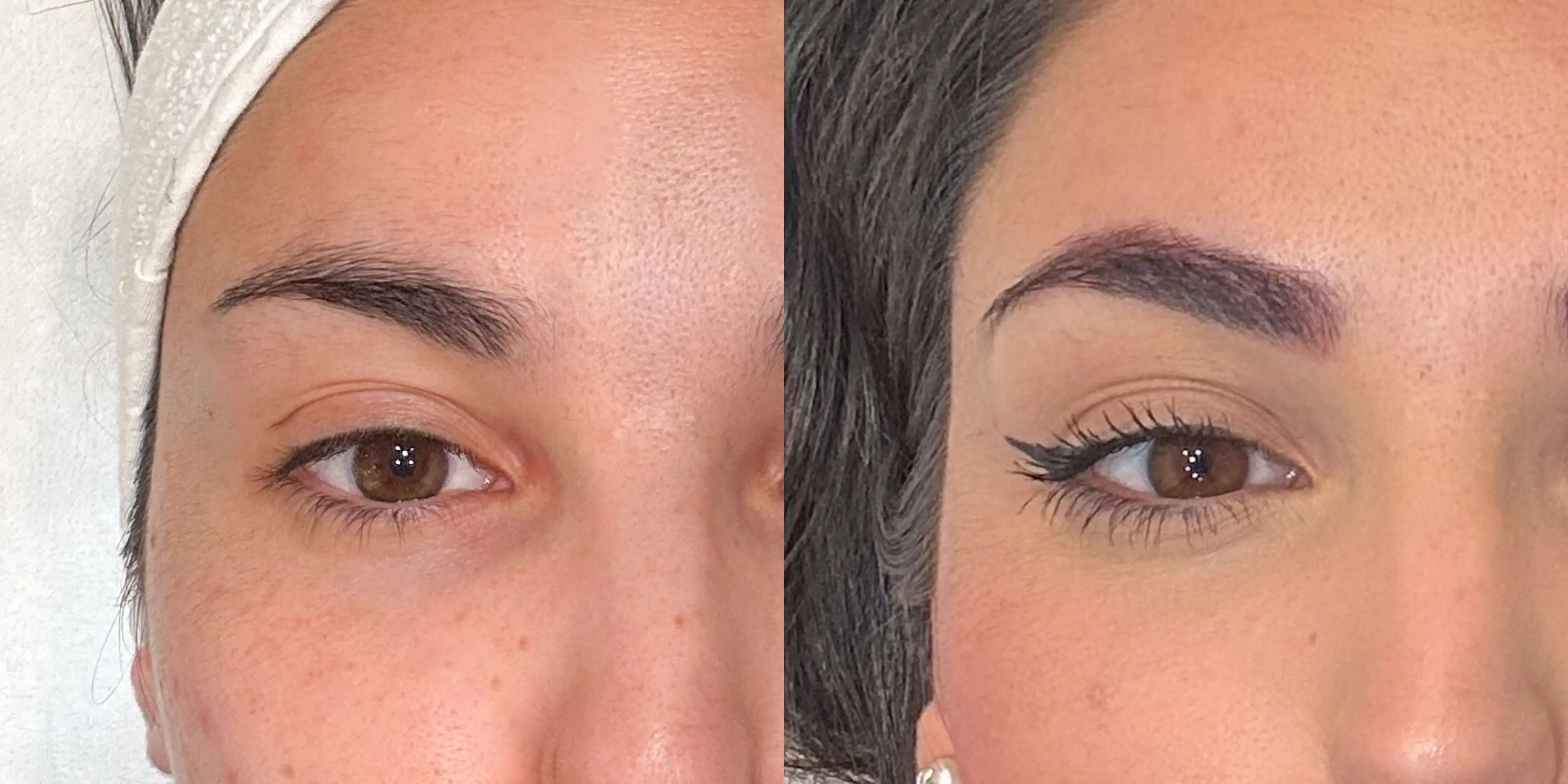 Antes y después de nuestros tratamientos de micropigmentación