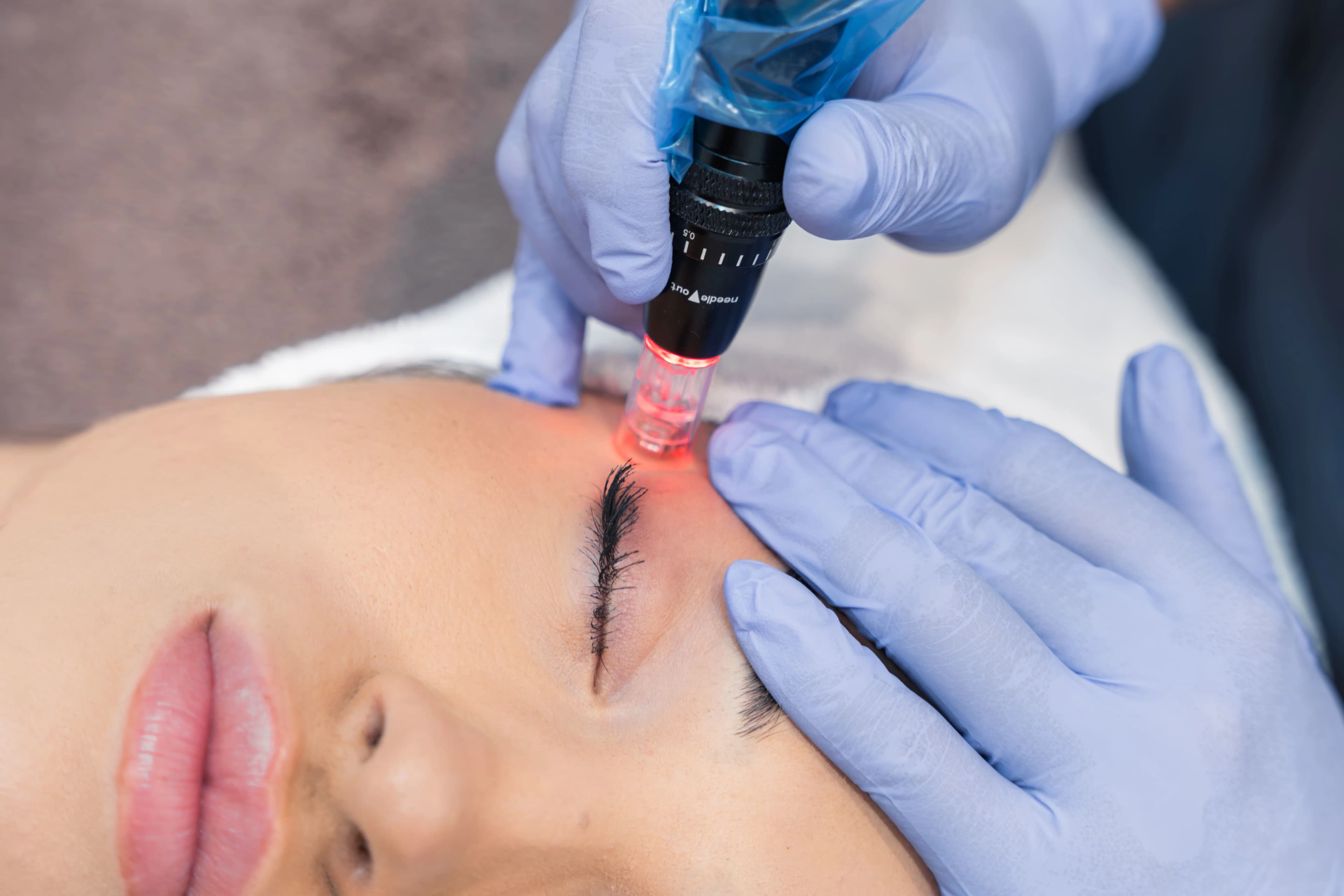 Tratamiento facial en Clínica Hera